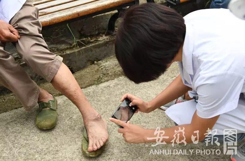 百医驻村 | 休宁县徐家村和清溪村的驻村医生张建明、徐晓婵夫妻