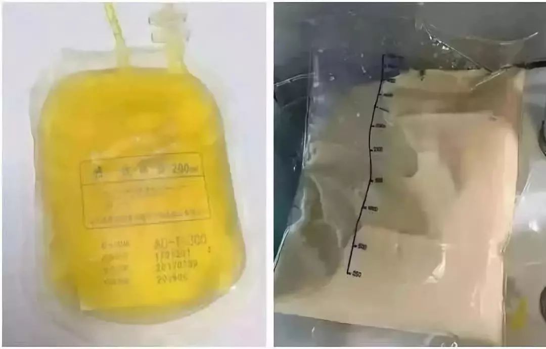 击垮一个成年人，一张体检报告就够了